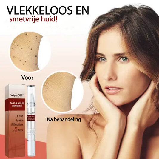 WipeOff™ | Wratten Verwijderaar | 1+1 Gratis